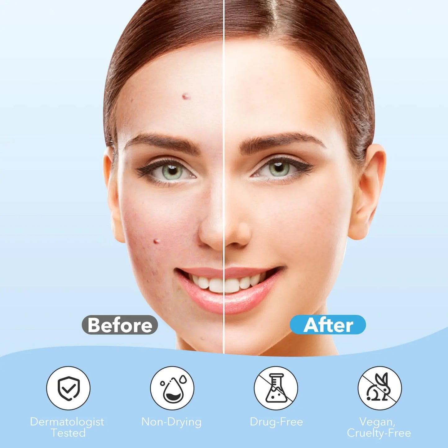 QUSTERE Pimple Patches for Face, Hydrocolloid Acne Patches, Cute round Shape Zit Covers, Spot Stickers with Tea Tree, Salicylic Acid & Cica Oil| 2 Sizes (9Mm, 12Mm) |288 Count Skincare Clear