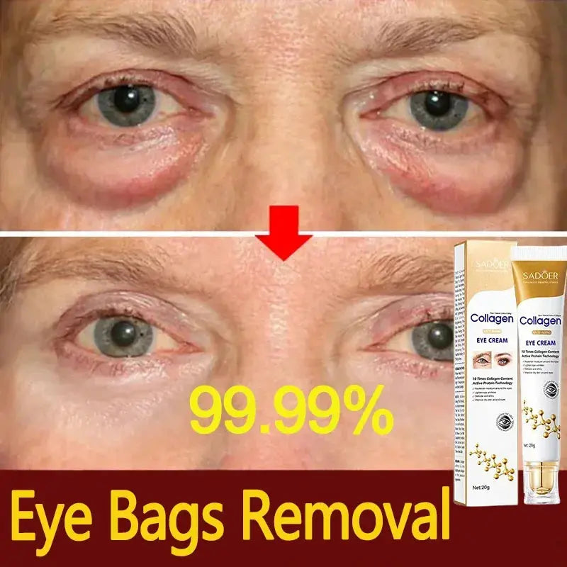 Instant Eye Bag Removal Cream Collagen anti Dark Circle Puffiness Brighten Eye Care Anti-Wrinkle Firming Skin Fade Fine Lines