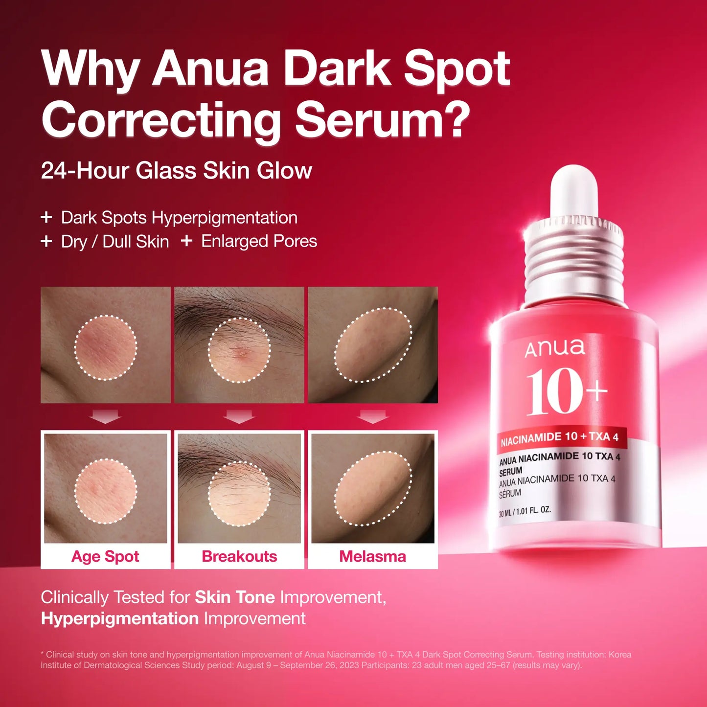 [Anua] Dark Spot Correcting Serum : 10% Niacinamide+ 4% Tranexamic Acid 1.01 Fl.Oz. (30Ml) ｜ Niacinamide Serum, PM Skincare Product, Hyperpigmentation, Brightening
