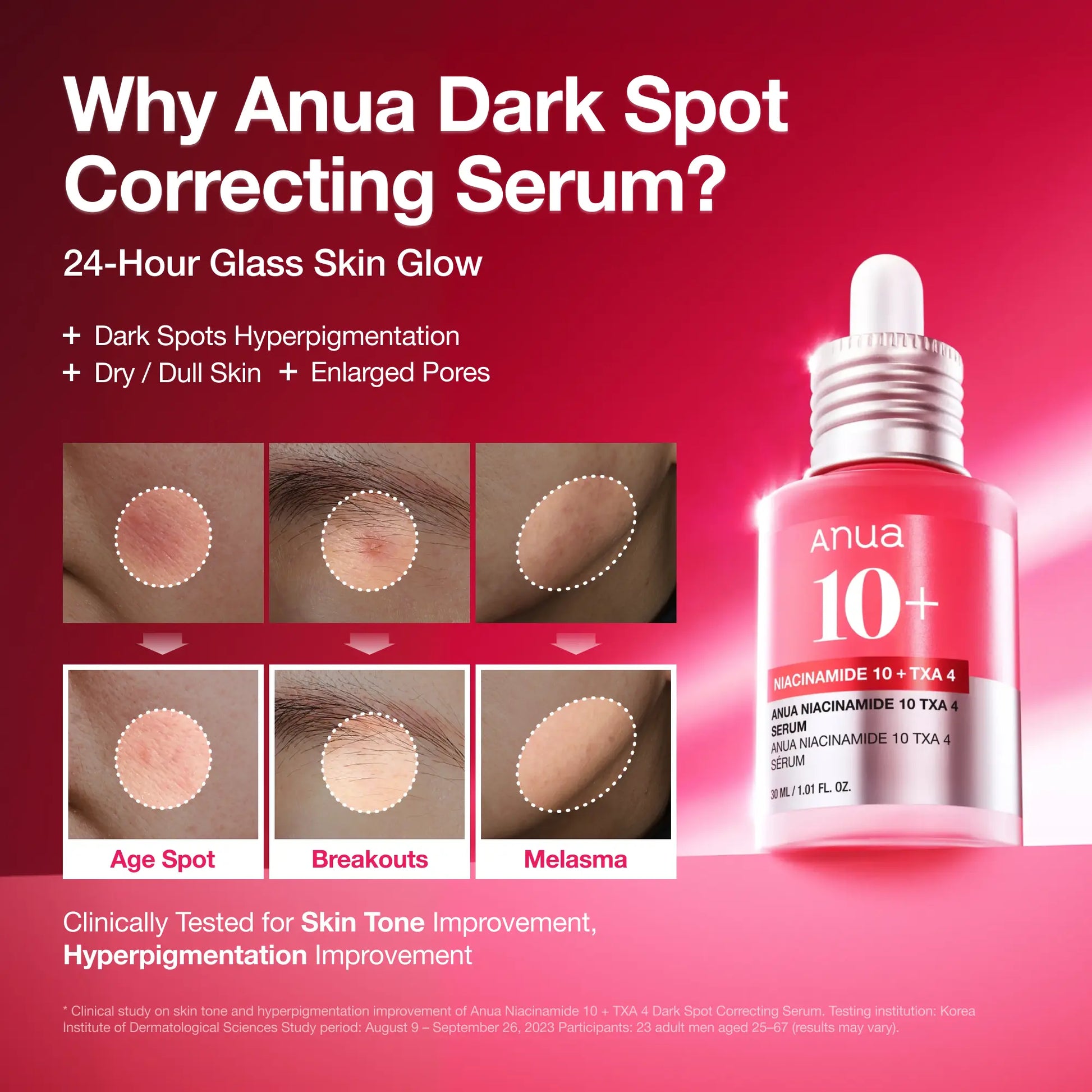 [Anua] Dark Spot Correcting Serum : 10% Niacinamide+ 4% Tranexamic Acid 1.01 Fl.Oz. (30Ml) ｜ Niacinamide Serum, PM Skincare Product, Hyperpigmentation, Brightening