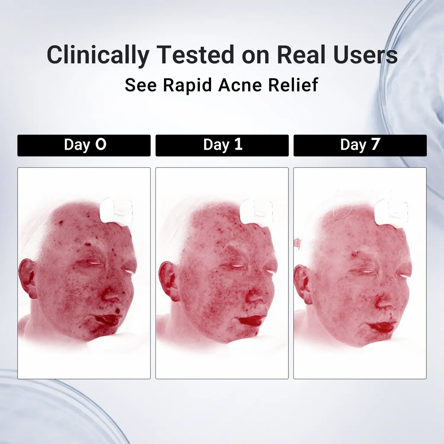 【Bundle & Save】Dr.Leo Salicylic Acid Acne Treatment Set | 24H Pimple Rescue + 15 Minutes Blackhead Removal + Pore Detox + Oil Control | Drying Lotion + Clay Mask Stick + Cleanser Skin Repair #Mothersdaygift #Summervibes
