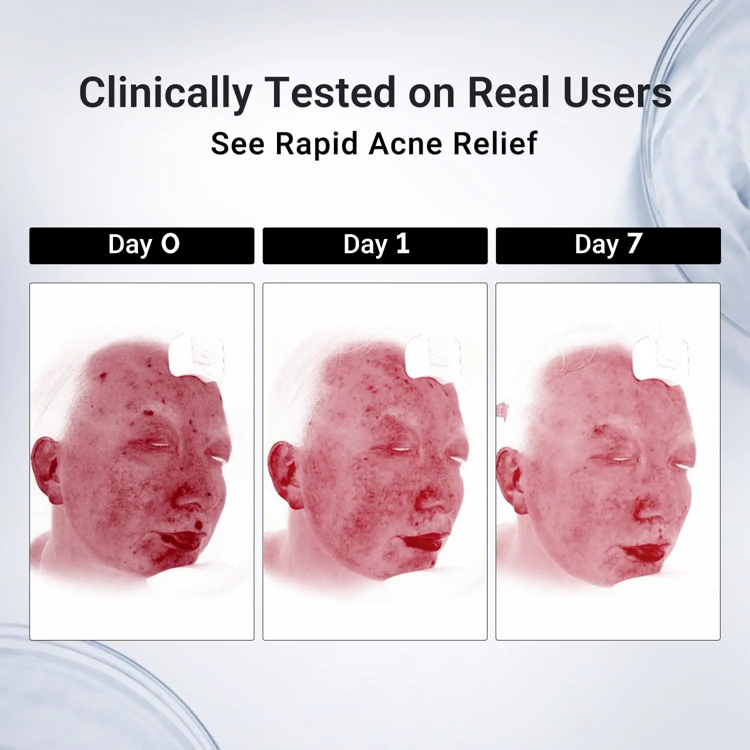 【Bundle & Save】Dr.Leo Salicylic Acid Acne Treatment Set | 24H Pimple Rescue + 15 Minutes Blackhead Removal + Pore Detox + Oil Control | Drying Lotion + Clay Mask Stick + Cleanser Skin Repair #Mothersdaygift #Summervibes