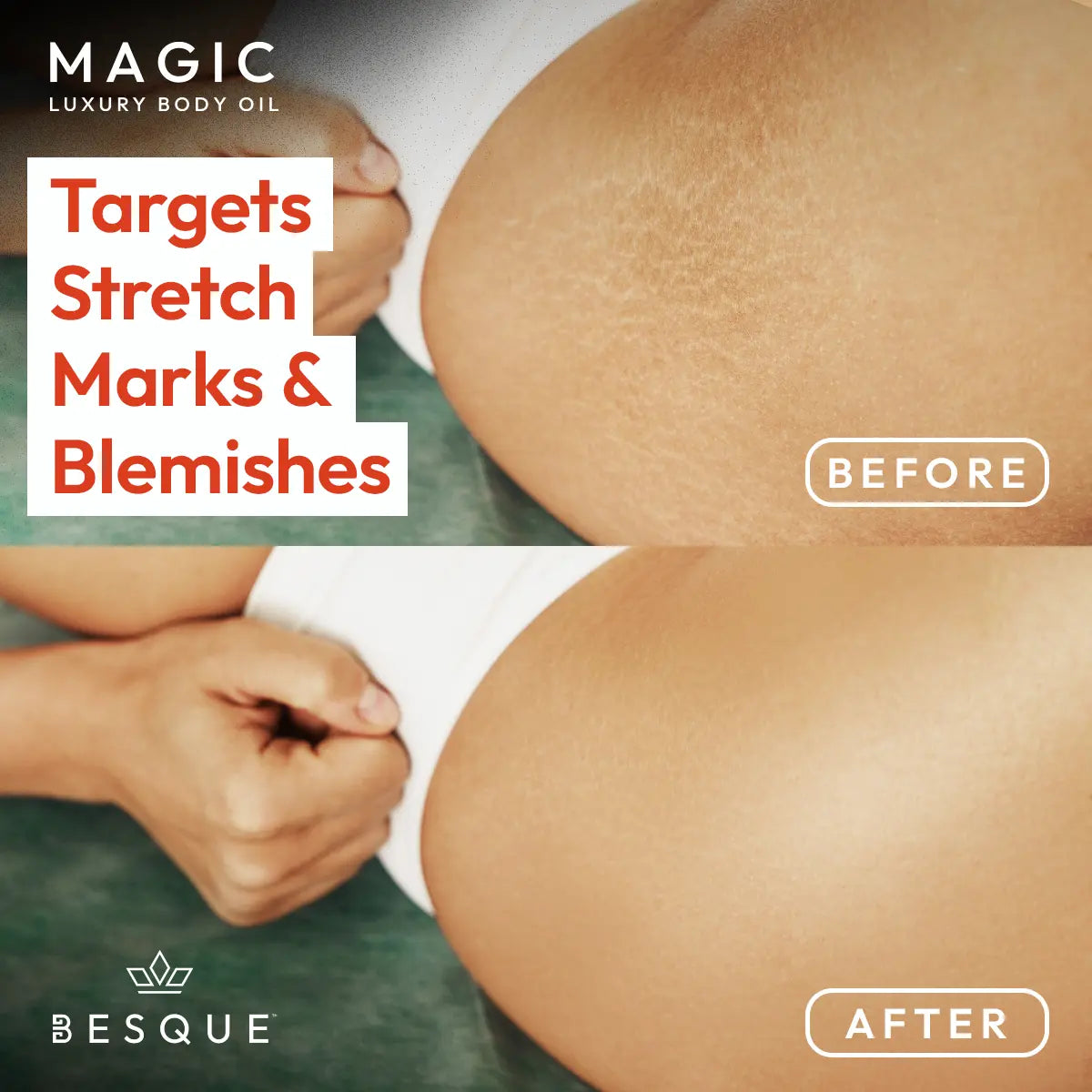 Besque™ Magic Body Oil - 100Ml