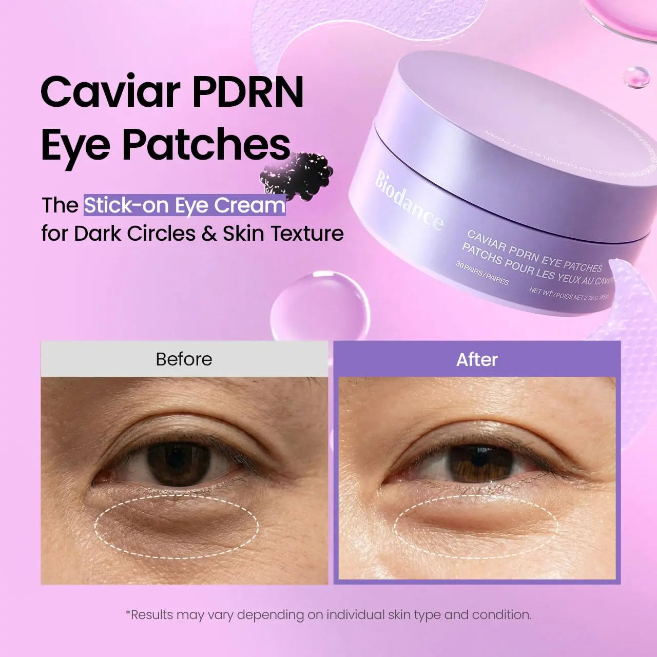 [Biodance Official] Collagen & PDRN Eye Patch for Wrinkle & Dark Circles | Collagen Peptide, Caviar PDRN, Korean Skincare Kit, under Eye Patches, Eye Patches Bundle, Puffy Eyes, Eyebag, Anti-Aging, Fine Line, Smile Line, Crow Feet, Dull Skin, Brightening