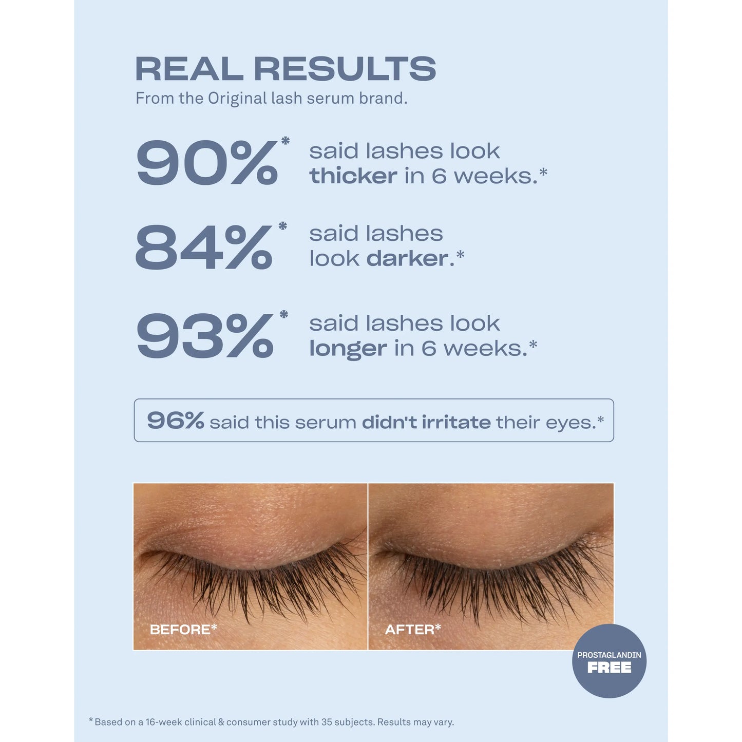 Renewing Lash Serum, Babe Lash Eyelash Serum, Prostaglandin-Free, Peptide-Powered Lash Serum, Support Fuller, Longer-Looking Lashes, Gentle & Effective, Easy to Use