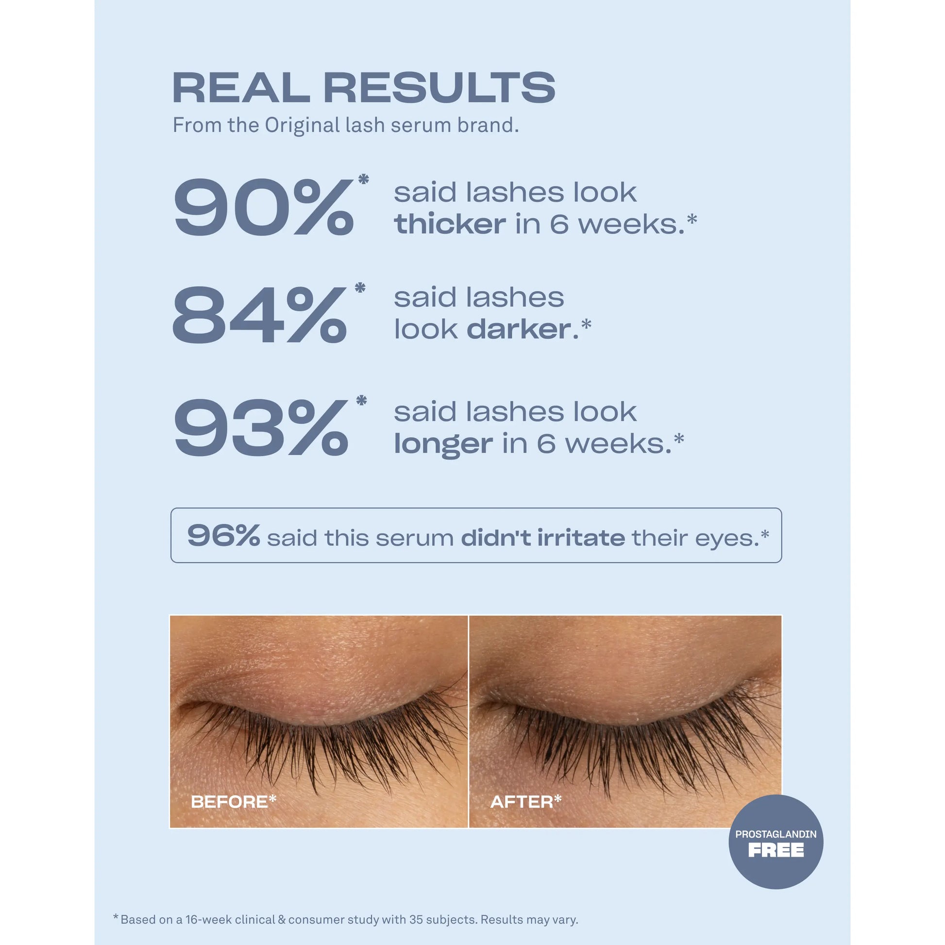 Renewing Lash Serum, Babe Lash Eyelash Serum, Prostaglandin-Free, Peptide-Powered Lash Serum, Support Fuller, Longer-Looking Lashes, Gentle & Effective, Easy to Use