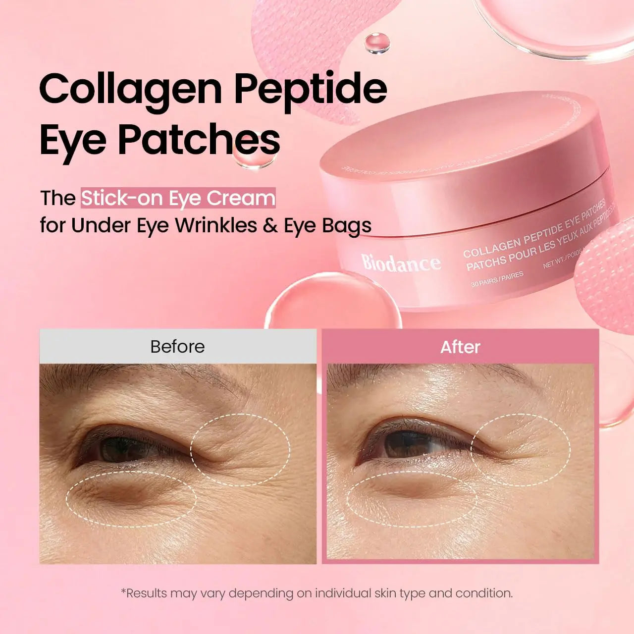 [Biodance Official] Collagen & PDRN Eye Patch for Wrinkle & Dark Circles | Collagen Peptide, Caviar PDRN, Korean Skincare Kit, under Eye Patches, Eye Patches Bundle, Puffy Eyes, Eyebag, Anti-Aging, Fine Line, Smile Line, Crow Feet, Dull Skin, Brightening