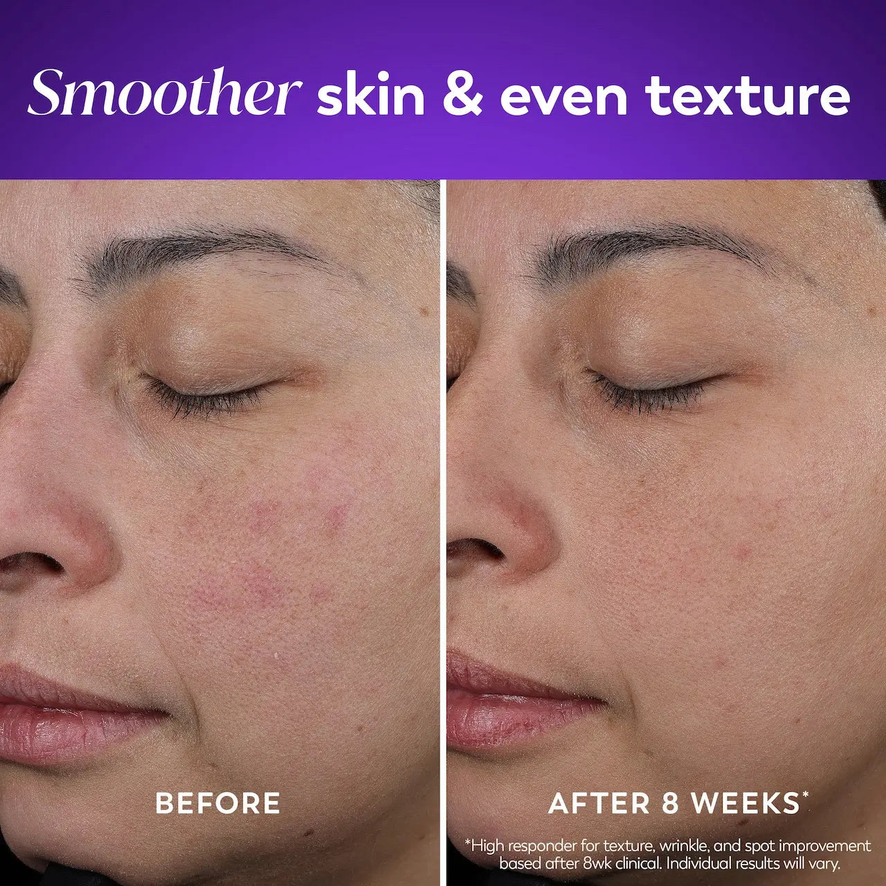 Olay Retinol24 Night Moisturizer - 24 Hour Hydration, Fine Lines, Wrinkles, Dark Spots, Elasticity, Pores, 1.7 Oz